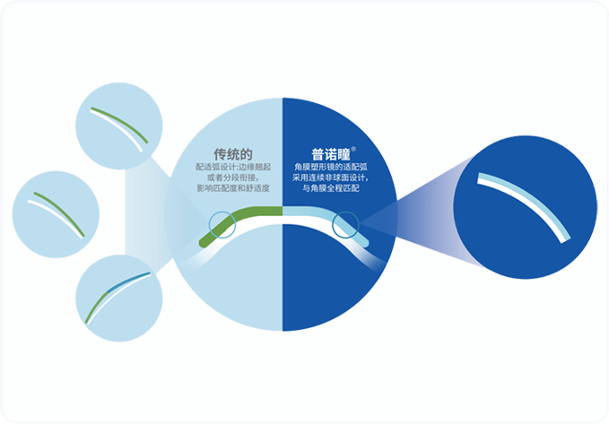 普诺瞳角膜塑形镜