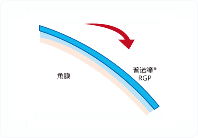 普诺瞳角膜塑形镜