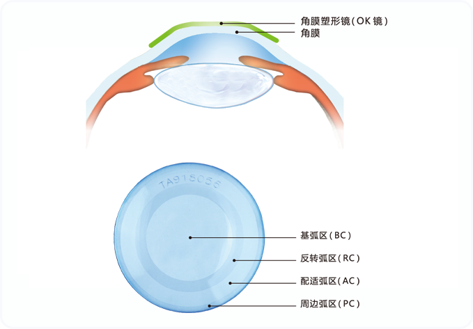 普诺瞳角膜塑形镜