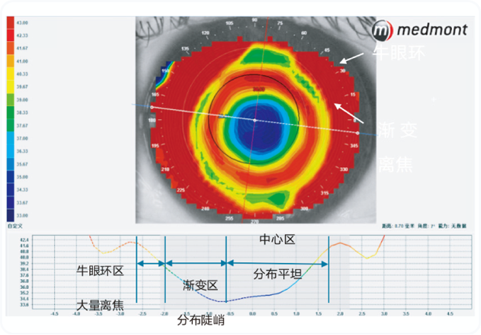 普诺瞳离焦软镜